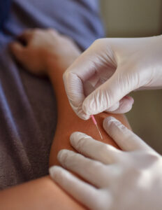 Fysiotherapie Zevenhuizen